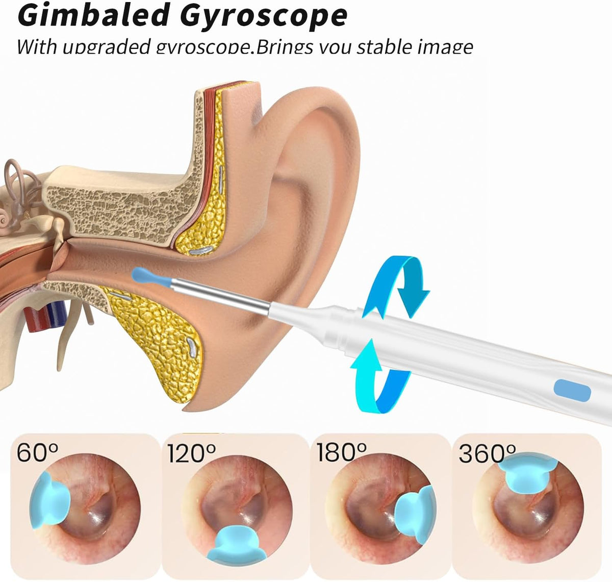 👂✨ Wireless Earwax Removal Tool Kit with 1080P Camera 😲